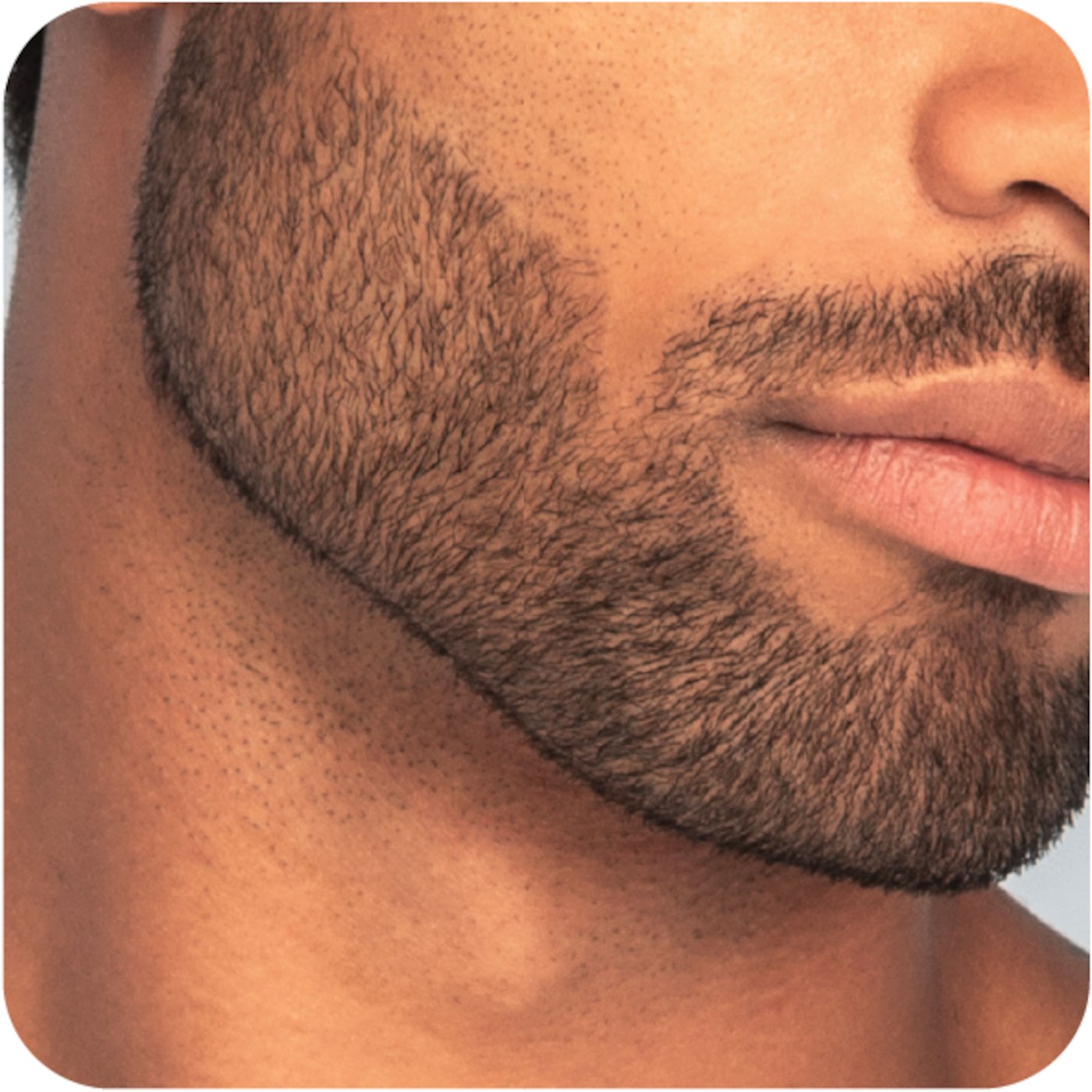 Remington MB7050 Hår- och skäggtrimmer